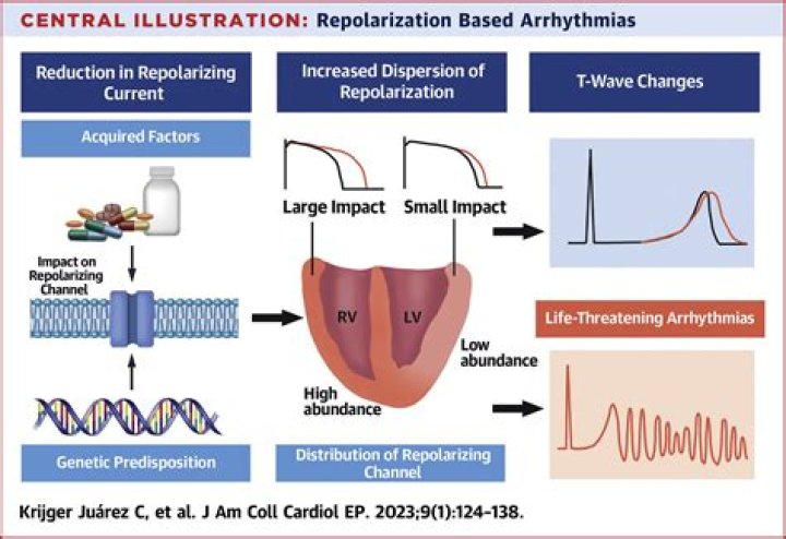 Is ventricular repolarization bad