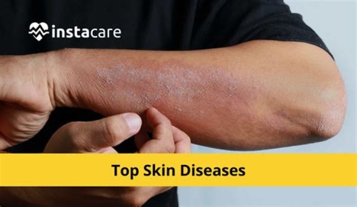 What are the top 10 skin diseases