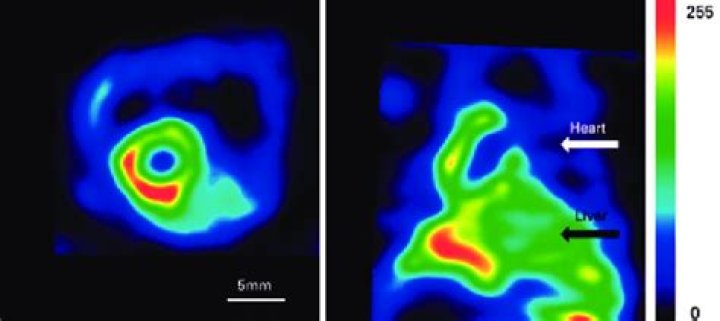 What is a sestamibi heart scan