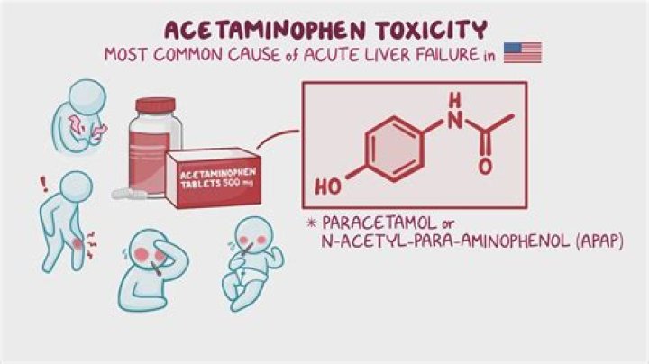 What is acetaminophen toxicity