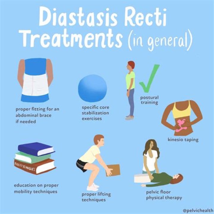 What is diastasis recti splint