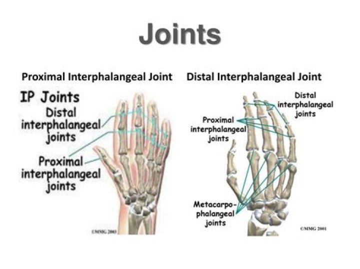 What is distal interphalangeal