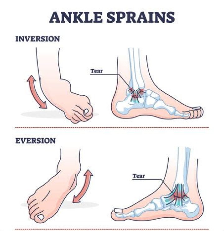 What is eversion and inversion