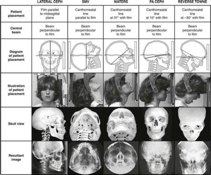 What is extra oral radiography