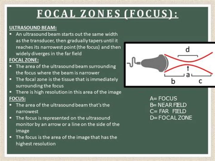 What is focusing in ultrasound