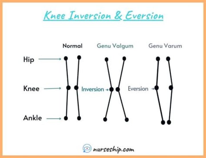 What is inversion and eversion