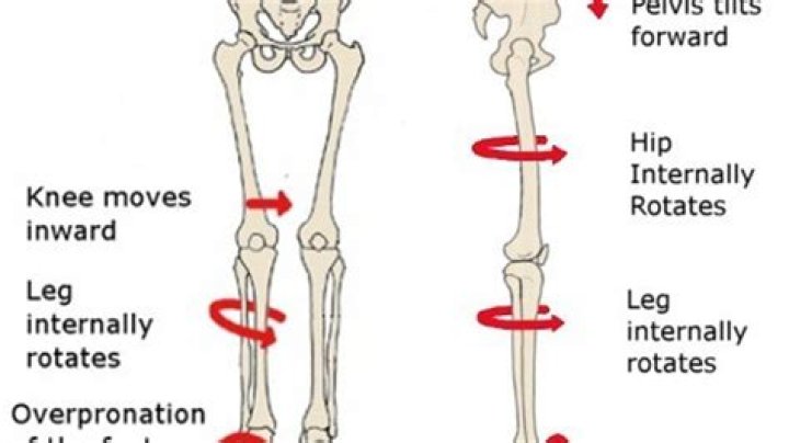 What is knee internal rotation