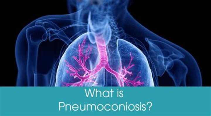What is pneumoconiosis disease