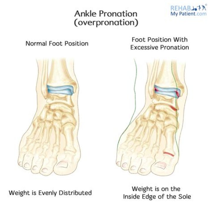 What is pronation of the ankle