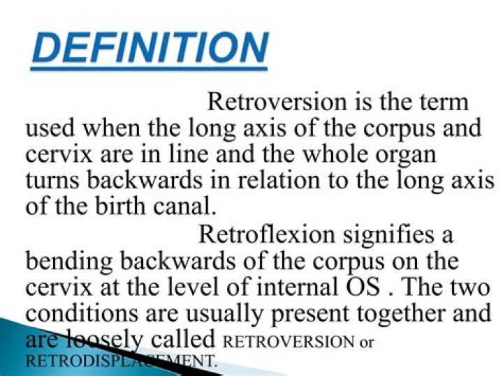 What is Retroversion of uterus